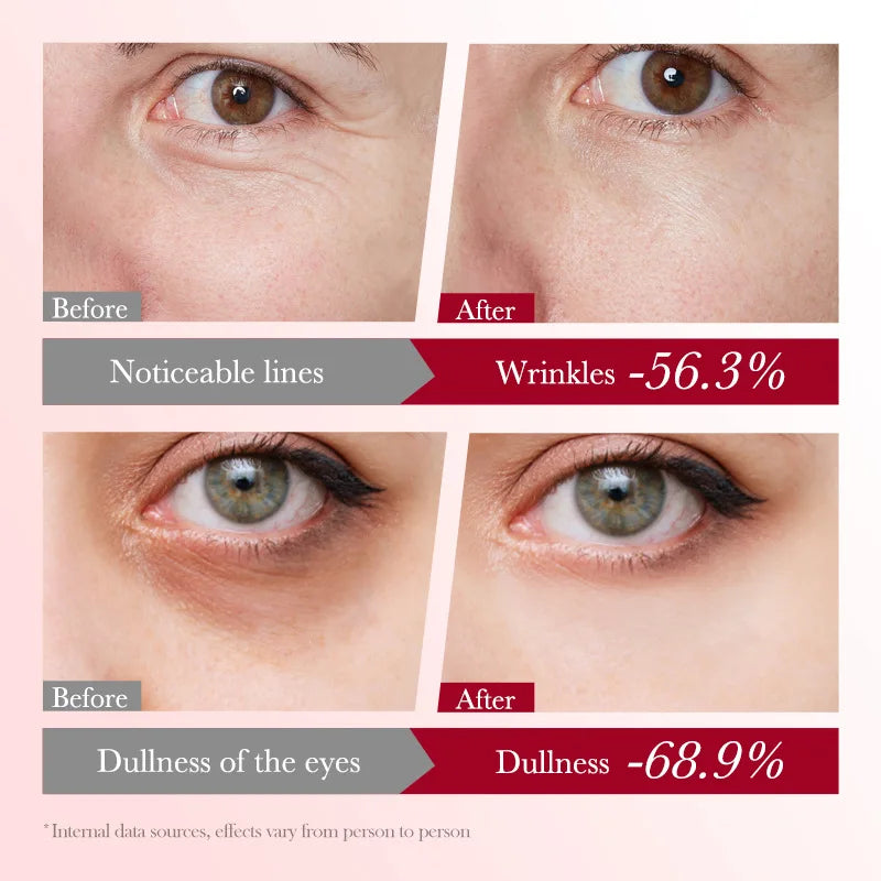 Crema de Ojos con Colágeno Sakura, Hidratante, Reafirmante, Iluminadora, Reduce las Ojeras, la Hinchazón, Suaviza las Líneas Finas, Antienvejecimiento, 20g