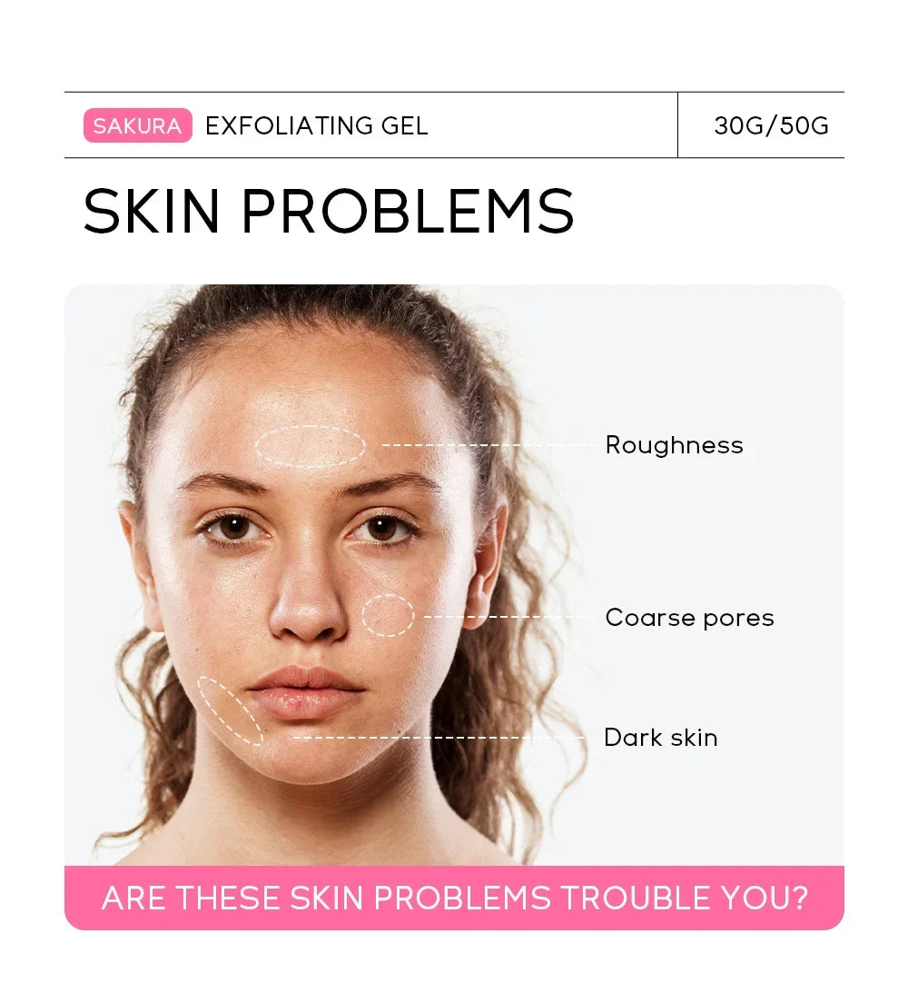 Sakura exfoliante Gel exfoliante exfoliante Facial hidratante nutritivo reparación exfoliantes crema Facial belleza cuidado de la piel 30g/50g